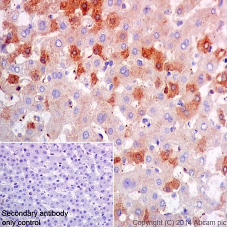 Immunohistochemistry (Formalin/PFA-fixed paraffin-embedded sections) - Anti-CFH + CFHL1 antibody [EPR17159] - BSA and Azide free (AB251314)