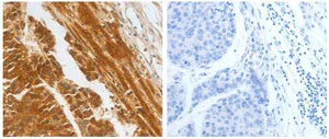 Immunohistochemistry (Formalin/PFA-fixed paraffin-embedded sections) - Anti-CFHR1 antibody (AB182652)