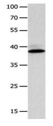 Western blot - Anti-CFHR1 antibody (AB182652)