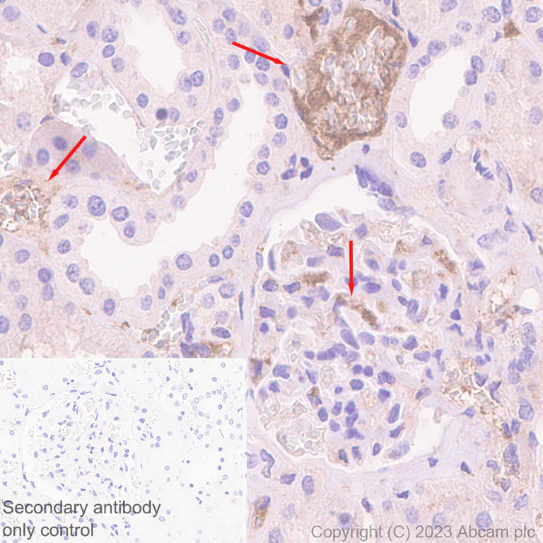 Immunohistochemistry (Formalin/PFA-fixed paraffin-embedded sections) - Anti-CFHR4 antibody [EPR25760-116] - BSA and Azide free (AB314306)