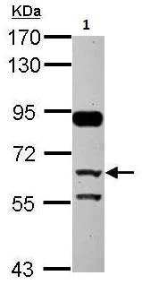 Western blot - Anti-CFHR5 antibody (AB262705)