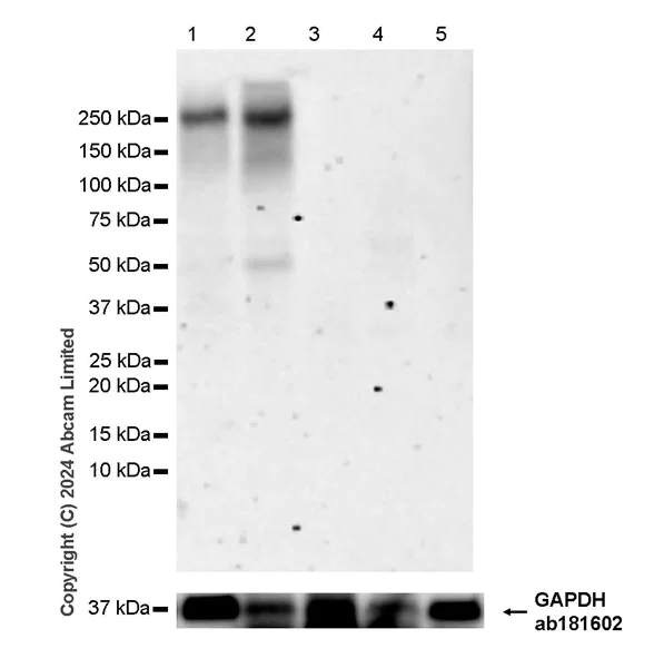 Western blot - Anti-CFTR antibody [EPR29524-130] (AB323314)