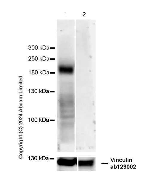Western blot - Anti-CFTR antibody [EPR29524-130] (AB323314)