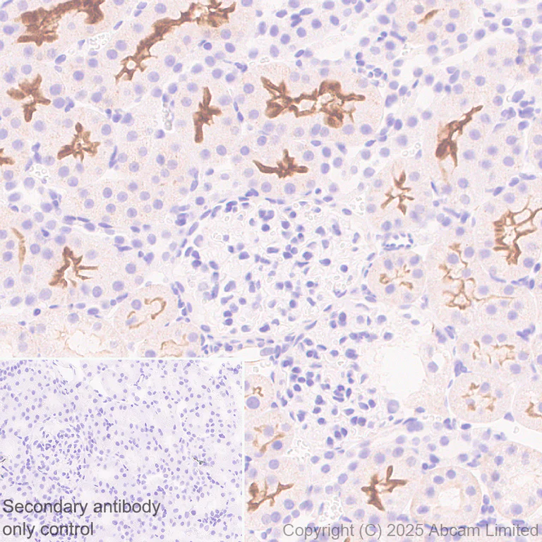 Immunohistochemistry (Formalin/PFA-fixed paraffin-embedded sections) - Anti-CFTR antibody [EPR29790-578] (AB325171)