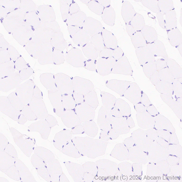 Immunohistochemistry (Formalin/PFA-fixed paraffin-embedded sections) - Anti-CFTR antibody [EPR29790-578] - BSA and Azide free (AB325186)
