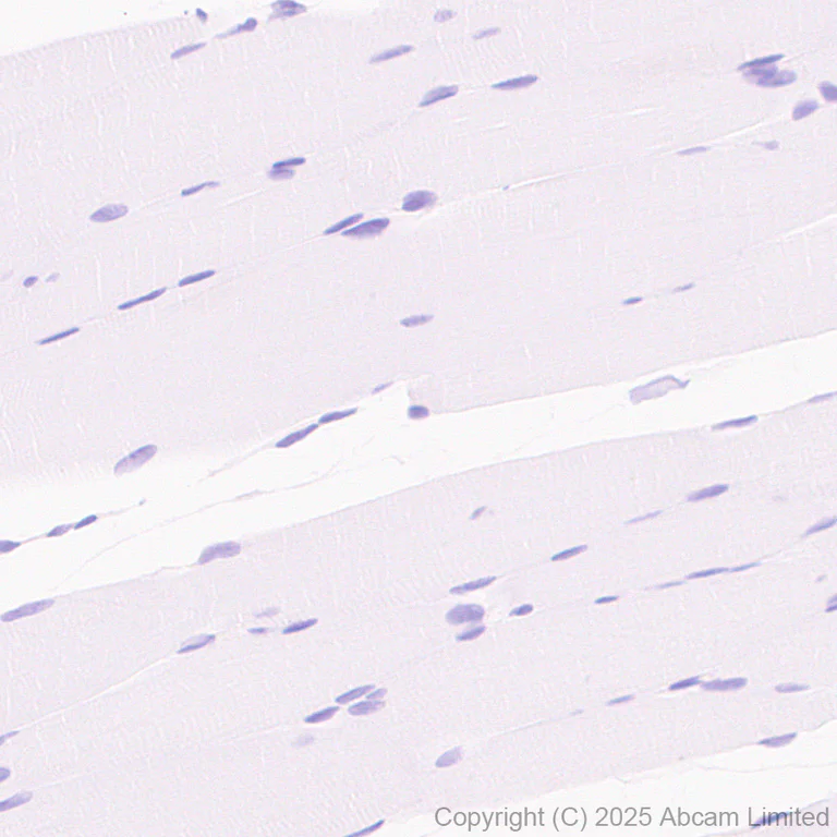 Immunohistochemistry (Formalin/PFA-fixed paraffin-embedded sections) - Anti-CFTR antibody [EPR29790-578] - BSA and Azide free (AB325186)