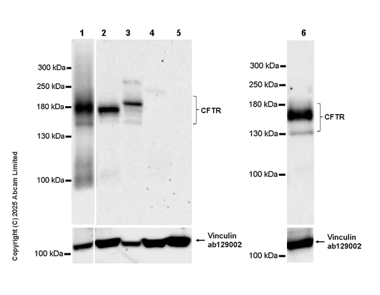 Western blot - Anti-CFTR antibody [EPR29790-578] - BSA and Azide free (AB325186)