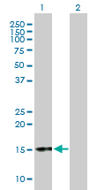Western blot - Anti-CGA/hCG alpha antibody (AB171770)