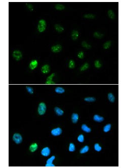Immunocytochemistry/ Immunofluorescence - Anti-CGA/hCG alpha antibody (AB196505)