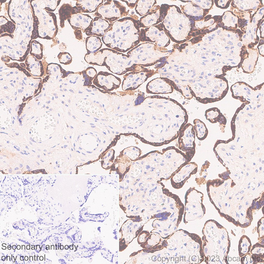 Immunohistochemistry (Formalin/PFA-fixed paraffin-embedded sections) - Anti-CGA/hCG alpha antibody [EP3373] (AB92738)