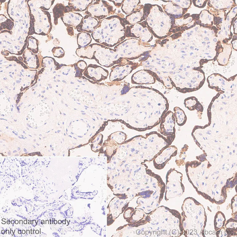 Immunohistochemistry (Formalin/PFA-fixed paraffin-embedded sections) - Anti-CGA/hCG alpha antibody [EP3373] - BSA and Azide free (AB254312)