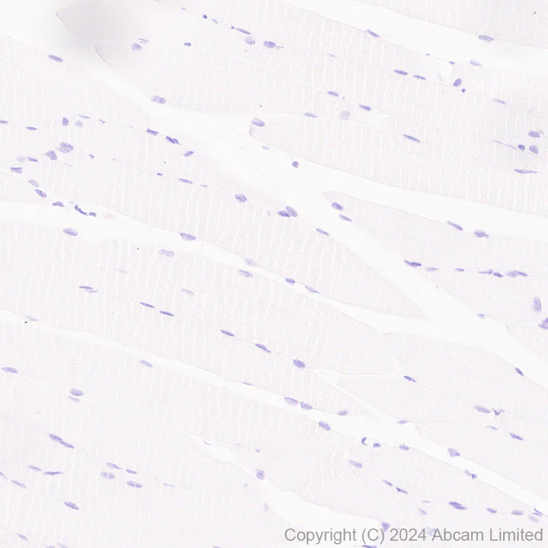 Immunohistochemistry (Formalin/PFA-fixed paraffin-embedded sections) - Anti-CGA/hCG alpha antibody [EPR19238-39] - BSA and Azide free (Capture) (AB259503)