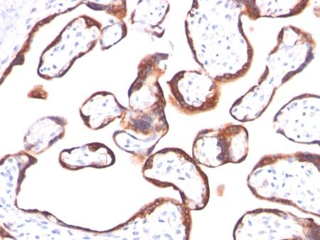 Immunohistochemistry (Formalin/PFA-fixed paraffin-embedded sections) - Anti-CGA/hCG alpha antibody [HCGa/53] (AB201329), expandable thumbnail