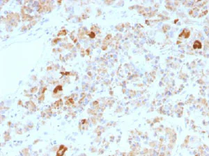 Immunohistochemistry (Formalin/PFA-fixed paraffin-embedded sections) - Anti-CGA/hCG alpha antibody [LHa/756] - BSA and Azide free (AB269757)