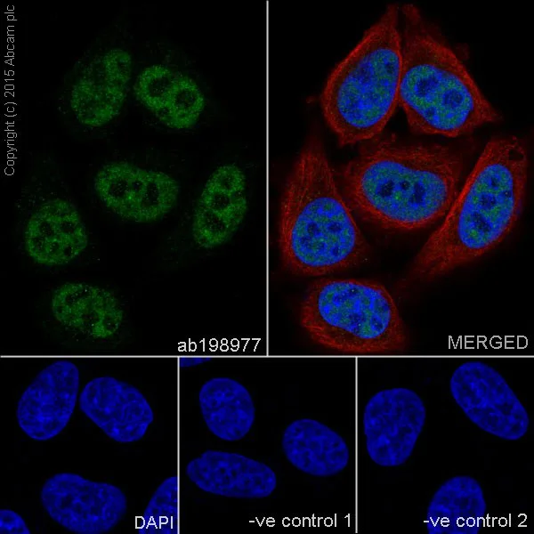 Immunocytochemistry/ Immunofluorescence - Anti-CGBP antibody [EPR19199] - BSA and Azide free (AB242431)