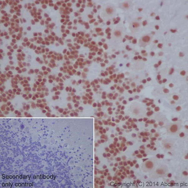 Immunohistochemistry (Formalin/PFA-fixed paraffin-embedded sections) - Anti-CGBP antibody [EPR19199] - BSA and Azide free (AB242431)