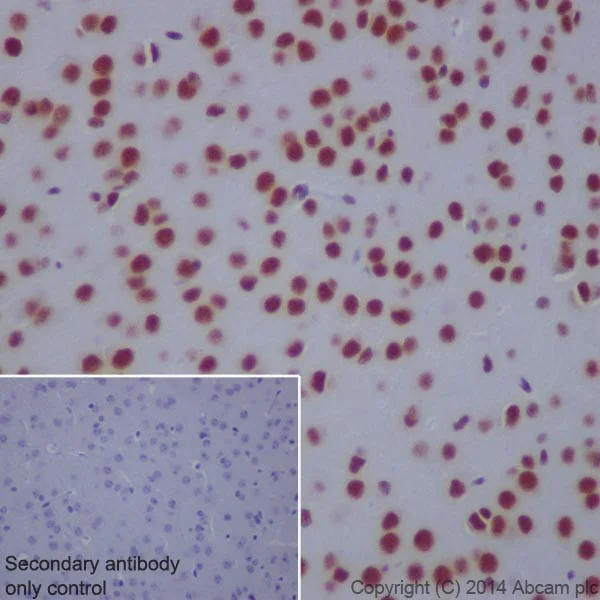 Immunohistochemistry (Formalin/PFA-fixed paraffin-embedded sections) - Anti-CGBP antibody [EPR19199] - BSA and Azide free (AB242431)