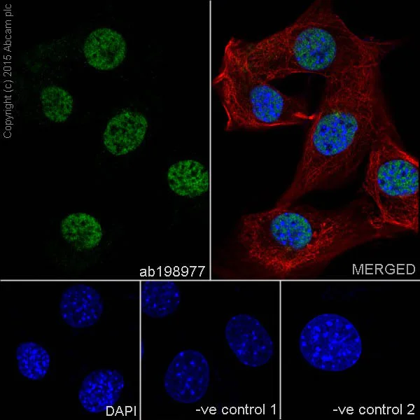 Immunocytochemistry/ Immunofluorescence - Anti-CGBP antibody [EPR19199] - ChIP Grade (AB198977)