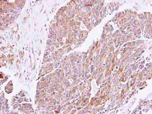 Immunohistochemistry (Formalin/PFA-fixed paraffin-embedded sections) - Anti-cGKI antibody (AB154724)