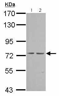 Western blot - Anti-cGKI antibody (AB154724)