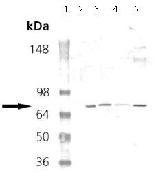 Western blot - Anti-cGKI antibody (AB69532)