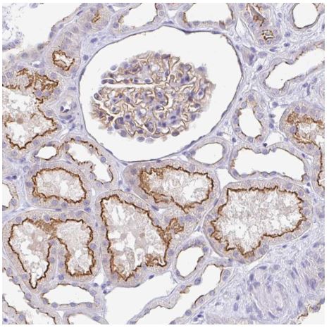 Immunohistochemistry (Formalin/PFA-fixed paraffin-embedded sections) - Anti-CGNL1/Paracingulin antibody (AB204500)