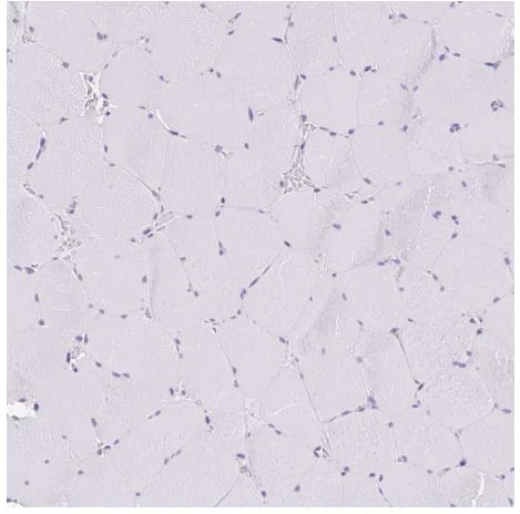 Immunohistochemistry (Formalin/PFA-fixed paraffin-embedded sections) - Anti-CGNL1/Paracingulin antibody (AB204500)