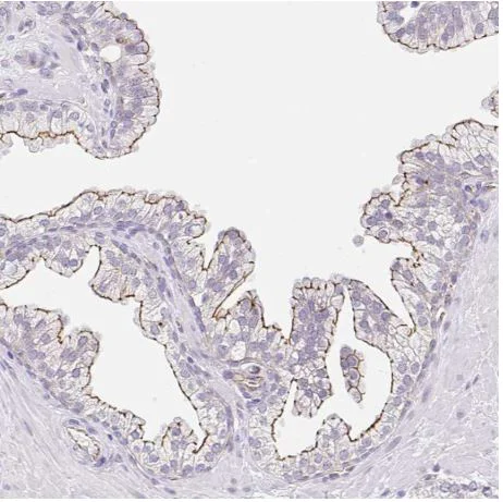 Immunohistochemistry (Formalin/PFA-fixed paraffin-embedded sections) - Anti-CGNL1/Paracingulin antibody (AB204500)