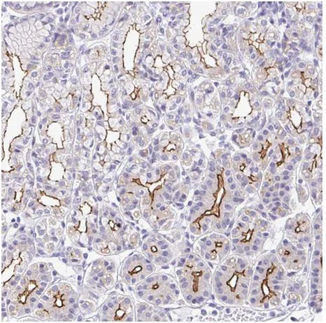 Immunohistochemistry (Formalin/PFA-fixed paraffin-embedded sections) - Anti-CGNL1/Paracingulin antibody (AB204500)