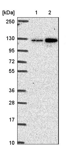Western blot - Anti-CGNL1/Paracingulin antibody (AB204500)