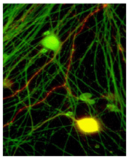 Immunocytochemistry/ Immunofluorescence - Anti-CGRP antibody [4901] (AB81887), expandable thumbnail