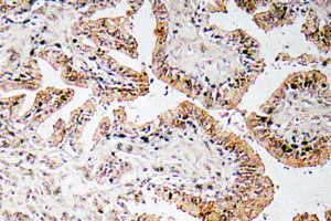 Immunohistochemistry (Formalin/PFA-fixed paraffin-embedded sections) - Anti-CGRP antibody (AB135271)