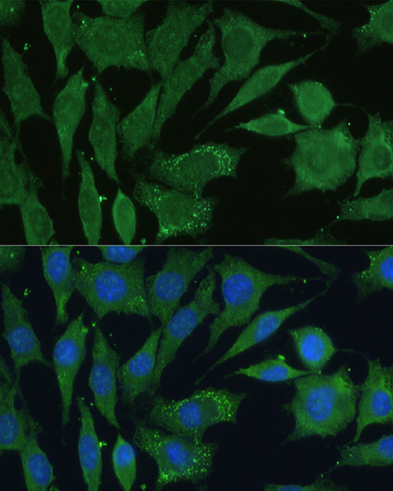 Immunocytochemistry/ Immunofluorescence - Anti-CGRP antibody (AB189786), expandable thumbnail