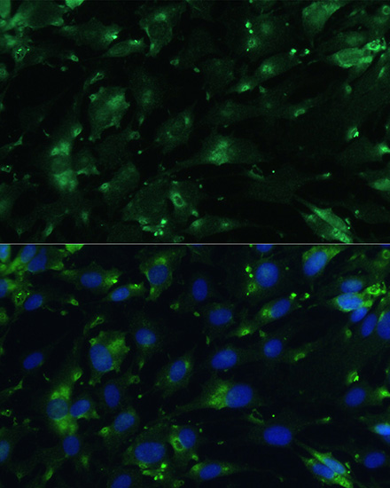 Immunocytochemistry/ Immunofluorescence - Anti-CGRP antibody (AB189786), expandable thumbnail