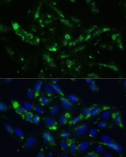 Immunocytochemistry/ Immunofluorescence - Anti-CGRP antibody (AB189786), expandable thumbnail