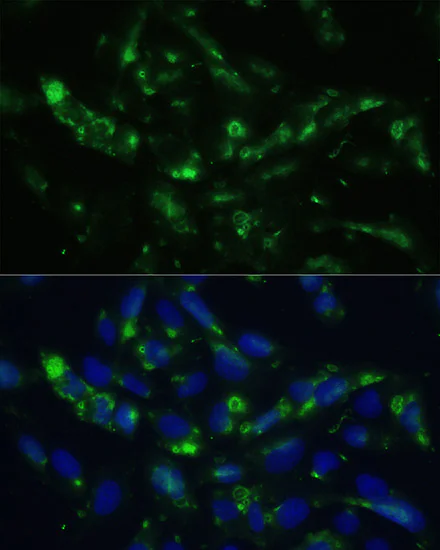 Immunocytochemistry/ Immunofluorescence - Anti-CGRP antibody (AB189786)