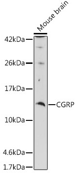Western blot - Anti-CGRP antibody (AB189786), expandable thumbnail