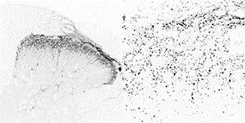 Immunohistochemistry (Formalin/PFA-fixed paraffin-embedded sections) - Anti-CGRP antibody (AB195387)