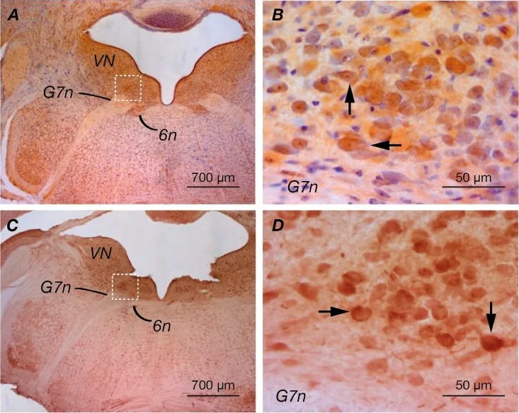 Immunohistochemistry (Formalin/PFA-fixed paraffin-embedded sections) - Anti-CGRP antibody (AB36001)