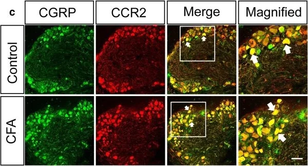 Immunohistochemistry (Frozen sections) - Anti-CGRP antibody (AB36001)