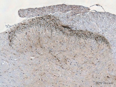 Immunohistochemistry (Formalin/PFA-fixed paraffin-embedded sections) - Anti-CGRP antibody (AB47027), expandable thumbnail