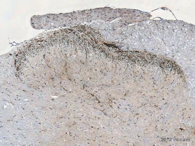 Immunohistochemistry (Formalin/PFA-fixed paraffin-embedded sections) - Anti-CGRP antibody (AB47027)