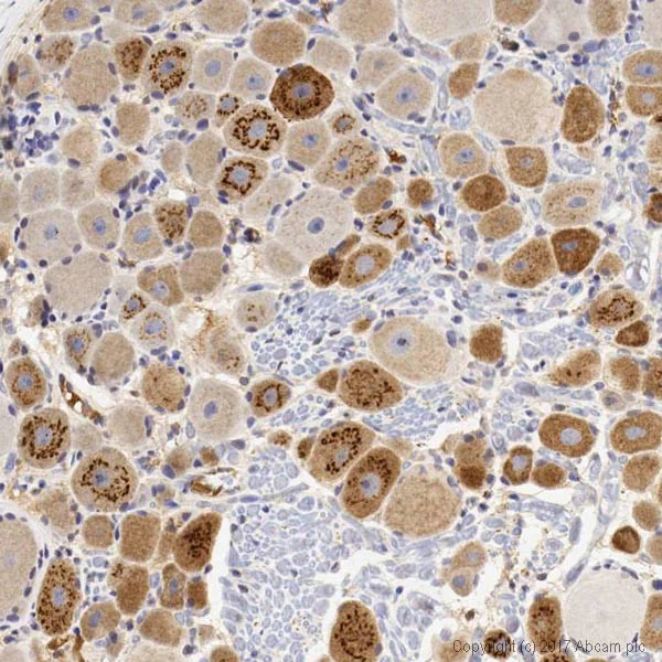 Immunohistochemistry (Formalin/PFA-fixed paraffin-embedded sections) - Anti-CGRP antibody (AB47027)