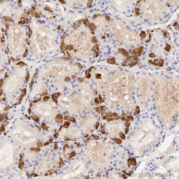 Immunohistochemistry (Formalin/PFA-fixed paraffin-embedded sections) - Anti-CGRP antibody (AB47027), expandable thumbnail