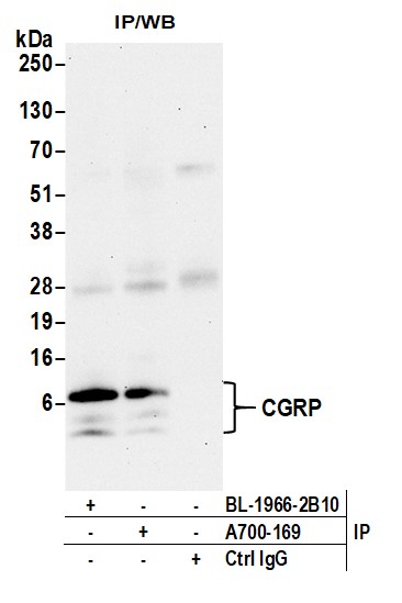 Immunoprecipitation - Anti-CGRP antibody [BLR169J] - BSA free (AB314084), expandable thumbnail