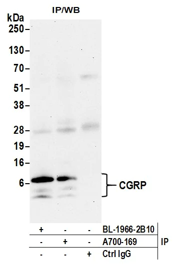 Immunoprecipitation - Anti-CGRP antibody [BLR169J] - BSA free (AB314084)