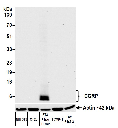Western blot - Anti-CGRP antibody [BLR169J] - BSA free (AB314084), expandable thumbnail