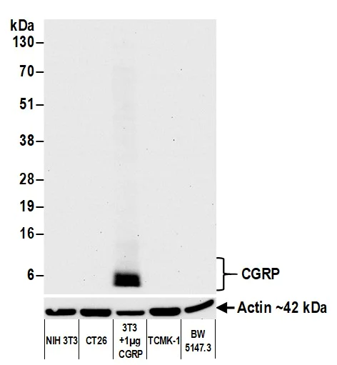 Western blot - Anti-CGRP antibody [BLR169J] - BSA free (AB314084)