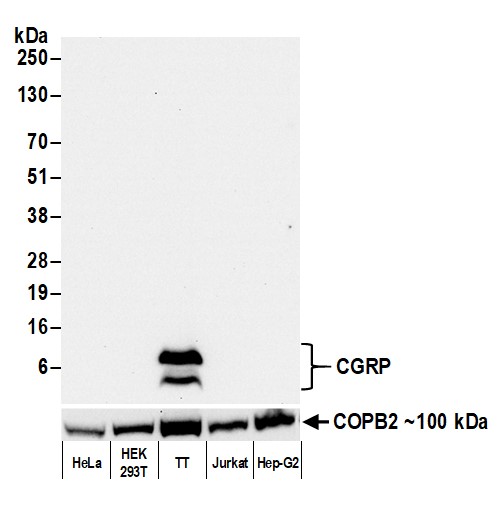 Western blot - Anti-CGRP antibody [BLR169J] - BSA free (AB314084), expandable thumbnail