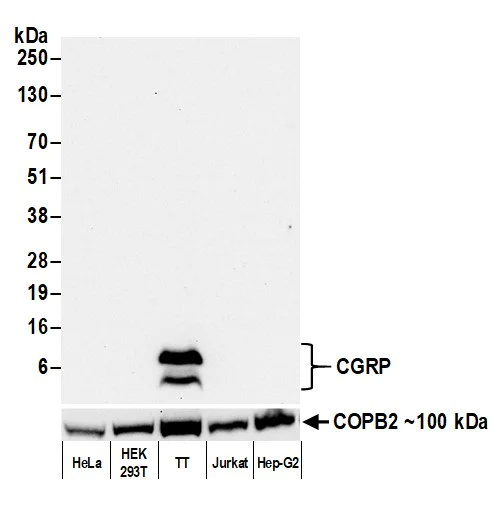 Western blot - Anti-CGRP antibody [BLR169J] - BSA free (AB314084)